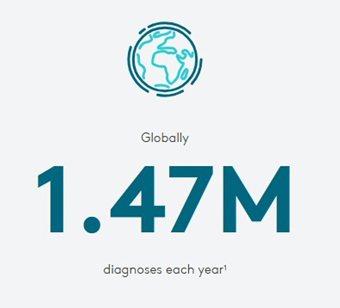 رادیوتراپی برای سرطان‌های زنان