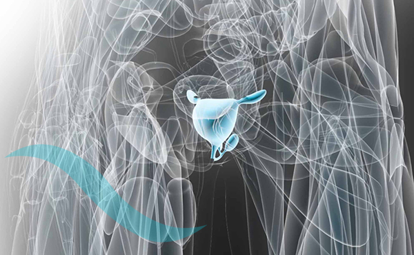 رادیوتراپی سرطان پروستات