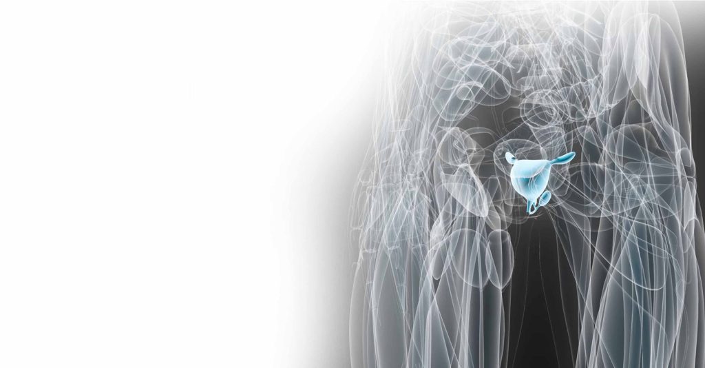 رادیوتراپی سرطان پروستات