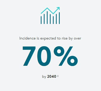 رادیوتراپی سرطان پروستات